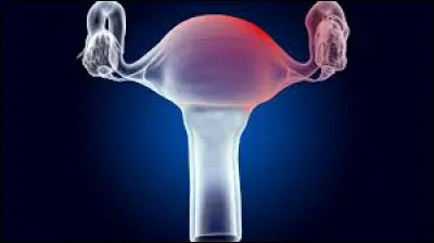 Quel syndrome est responsable de la survenue de 10 % des cancers de l'endomètre chez les jeunes femmes ?