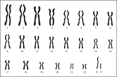 VINGT-ET-UN - Comment se caractérise la trisomie 21 ?
