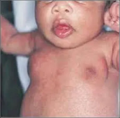 Qu'est-ce que le lait de sorcière ?