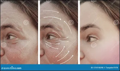 Quelle est ta couleur de peau ? (Si elle ny est pas, quelle est celle qui se rapproche le plus ?)