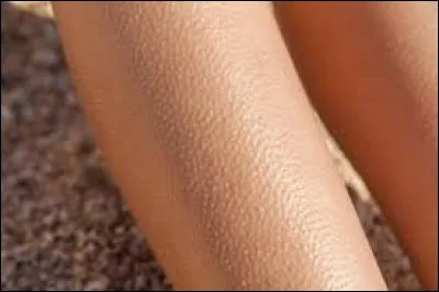 La peur lui a donné la ... de poule