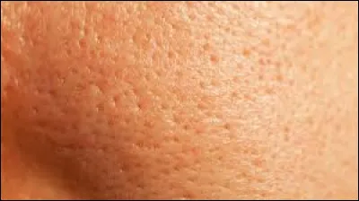 Pourquoi les ... sont-ils dilatés ?