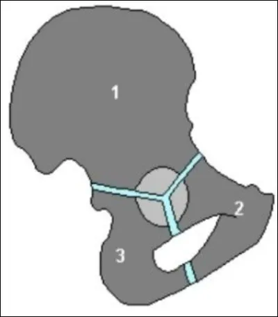Quel est l'os n°1 de la synostose ?