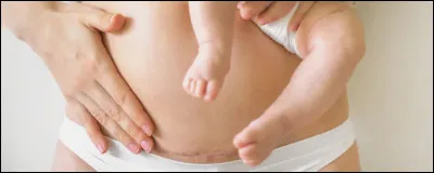 Que veut dire l'expression "retour de couche" ?