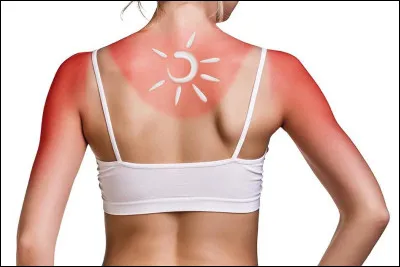 Ne prenez pas de risques, restez &agrave; l'ombre !