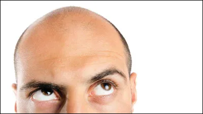 Es-tu proche de la calvitie ?