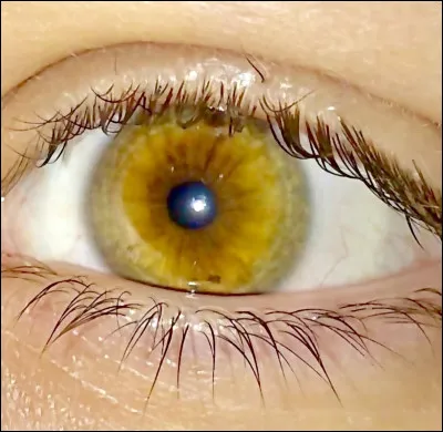 Quelle est la couleur des yeux de 0,001% de la population dans le monde ?