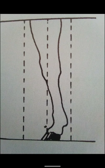 Comment s'appelle cet aplomb ?