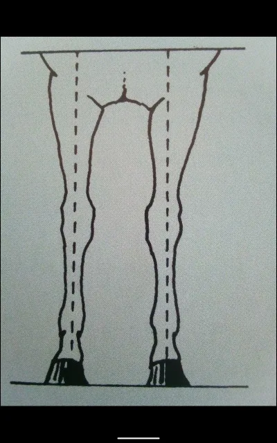 Quel est cet aplomb ?