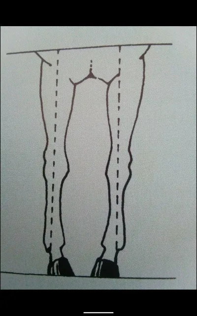 Quel est cet aplomb ?