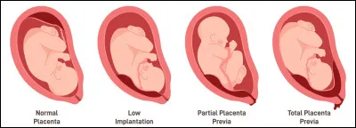 Quelles sont les annexes ?