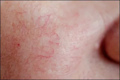 Se dessine comme une fleur.