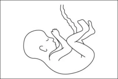 2006 - Comment s'appelle le couple mis en examen pour l'affaire des b&eacute;b&eacute;s congel&eacute;s ?