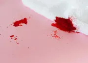 Quiz Phobie � l'�tude : H�matophobie