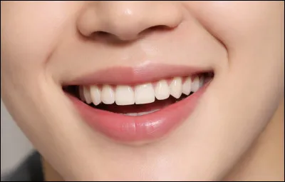 &Agrave; quel membre appartient ce sourire ?