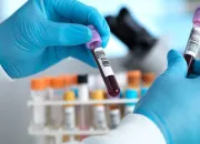 Quiz Quiz de biochimie