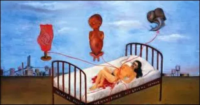 Pourriez-vous me citer le nom de cette surr&eacute;aliste qui a r&eacute;alis&eacute;, en 1932, cette toile intitul&eacute;e ''L'H&ocirc;pital Henry Ford'', &eacute;galement appel&eacute;e ''Le Lit qui vole'' ?