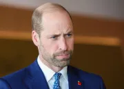 Quiz Soci�t� - Les pays comptant la plus grande proportion d'hommes chauves au monde