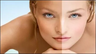 Les personnes &agrave; la peau claire au soleil sont plus expos&eacute;es &agrave; quel type de maladie ?