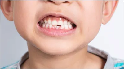 Quel animal poss&egrave;de le plus grand nombre de dents ?