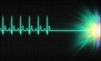 Comment appelle-t-on un rythme cardiaque rapide ?