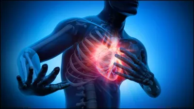 La crise cardiaque est...