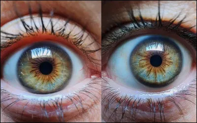 Quelle est la couleur des yeux la moins pr&eacute;sente chez les humains ?