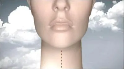 De quel gnrique est tire cette image ?