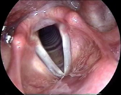 Où sont situées les cordes vocales ?