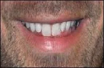 A qui appartient cette bouche ?