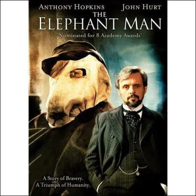 Elephant man