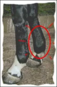 Quels sont les symptmes d'une tendinite ?