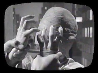 Dans quel pisode une patiente qui se croit dfigure est en ralit entoure de monstres qui veulent la transformer  leur image ?