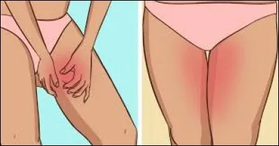 Quel est le nom des muscles de l'intérieur de la cuisse ?