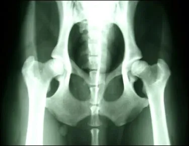 Qui découvrit les rayons X en 1895 et obtint pour cela le prix Nobel de physique ?