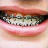 Je vous mets des appareils dentaires, qui suis-je ?