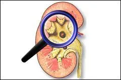 De quel organe le néphrologue est-il le spécialiste ?