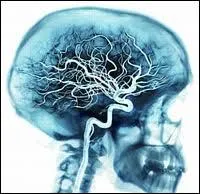 100000000000000000000000000000 + 1 = ? ( 1 seul rponse )