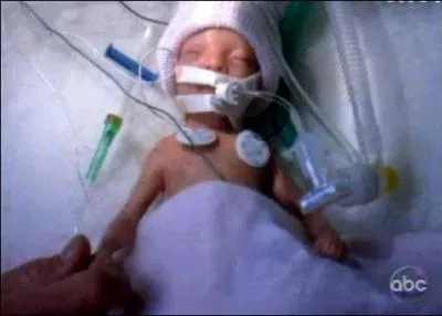 Combien pse la fille de Callie  sa naissance ?