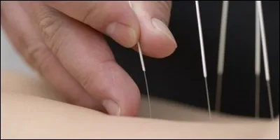 Celui qui pose des aiguilles sur la peau est :