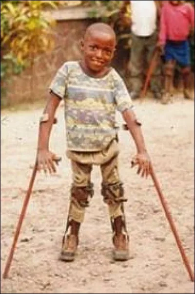 Quelle personnalité n'est pas handicapée par la poliomyélite ?