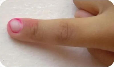 What is it ? ( doigt)