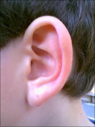 What is it ? ( oreille).