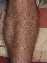 Quelle crme va rsoudre ce problme ?