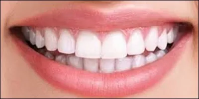 On a le même nombre de dents de lait que de dents définitives.