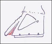 En cas de fourbure, la rotation de la troisime phalange de 10% est ...