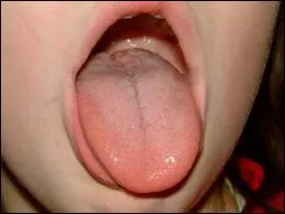 Le muscle le plus fort du corps est la langue, c'est ... ...