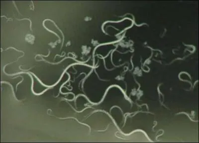 Comment se nomme ce petit ver, dont plusieurs espces sont de redoutables parasites, aussi bien pour les plantes que pour les animaux ou les hommes ?