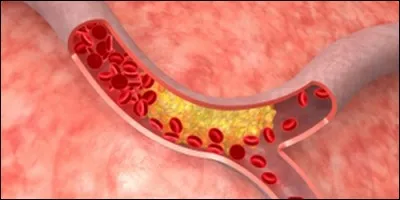 Je suis un vaisseau qui porte le sang du coeur aux organes, je suis aussi une voie de circulation urbaine. Que suis-je ?