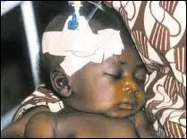 C'est le champion toutes catgories, il vaut mieux viter le cousinage, vous vous feriez du mauvais sang : Plus de 2 millions de morts par an !